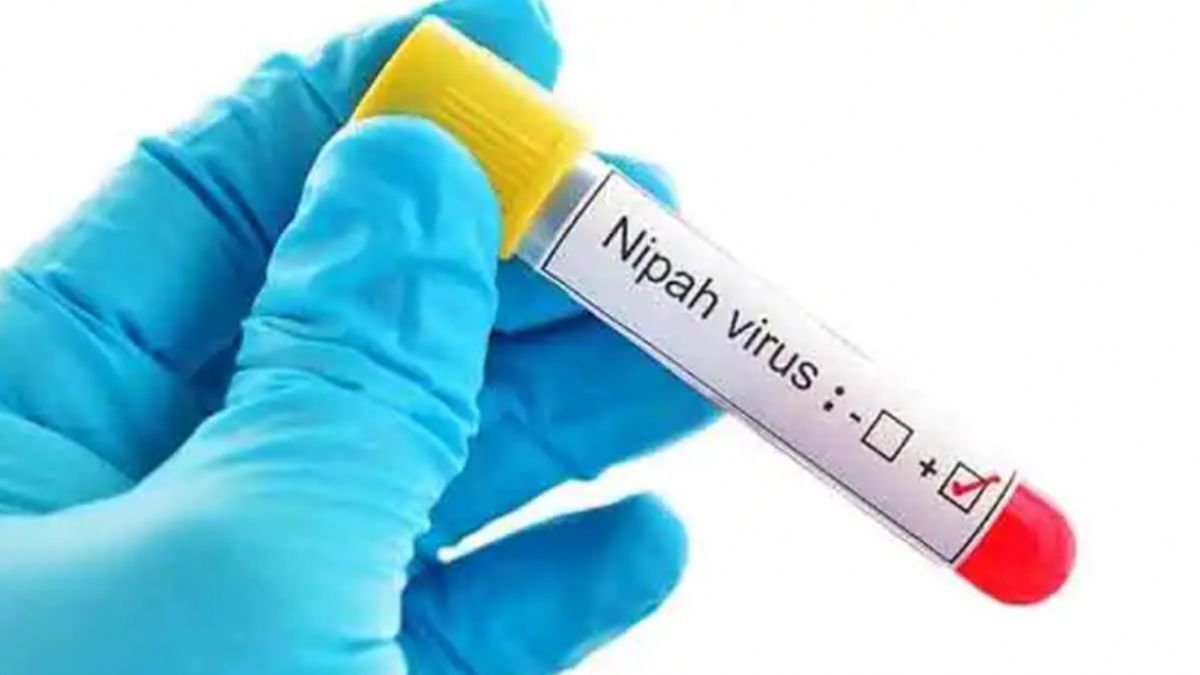 Nipah Virus: নতুন করে ভয় ধরাচ্ছে নিপা ভাইরাস, প্রাণ কাড়ল ১৪ বছরের কিশোরের