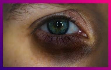 Dark Circles Removal: ডার্ক সার্কেল থেকে মুক্তি দেবে অ্যালোভেরার সঙ্গে এই ৩টি জিনিসের মিশ্রণ, জেনে নিন ডার্ক সার্কেল থেকে মুক্তি পাওয়ার ঘরোয়া উপায়...