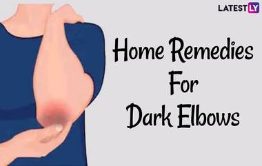 Home Remedies For Dark Elbows: কনুইয়ের কালো দাগ দূর করে ত্বককে উজ্জ্বল ও কোমল করুন ঘরোয়া উপায়ে, জেনে নিন বিস্তারিত