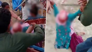 Uttar Pradesh Shocking Video: মর্মান্তিক ভিডিয়ো দেখলে আঁতকে উঠবেন; নাগরদোলায় আটকে গেল চুল, আশঙ্কাজনক অবস্থায় উদ্ধার রক্তাক্ত কিশোরী