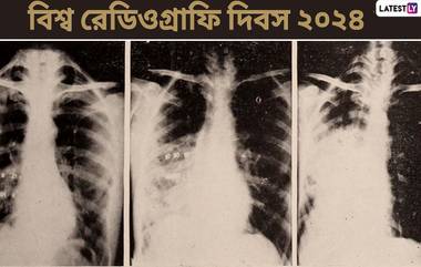 World Radiography Day 2024: বিশ্ব রেডিওগ্রাফি দিবস কবে? জেনে নিন বিশ্ব রেডিওগ্রাফি দিবসের ইতিহাস ও গুরুত্ব...