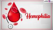 Hemophilia: হিমোফিলিয়া গুরুতর রক্ত সম্পর্কিত রোগ, জেনে নিন হিমোফিলিয়ার লক্ষণ ও চিকিৎসা...