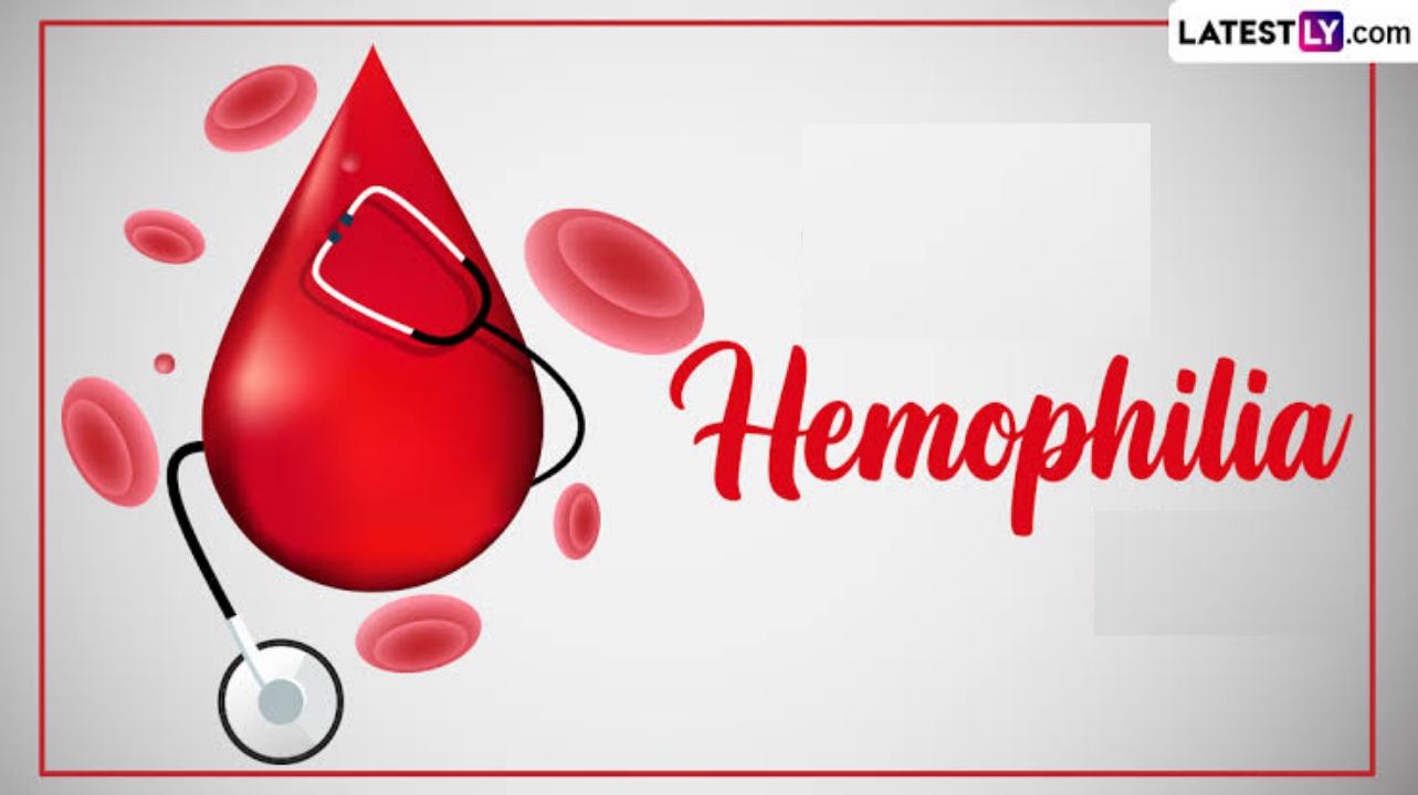 Hemophilia: হিমোফিলিয়া গুরুতর রক্ত সম্পর্কিত রোগ, জেনে নিন হিমোফিলিয়ার লক্ষণ ও চিকিৎসা...