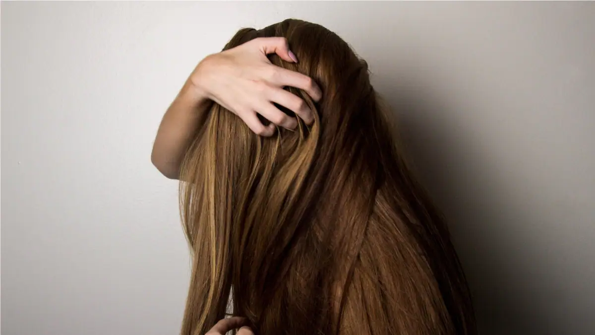Dandruff Removal Tips: শীত শেষ হওয়ার পরও মাথায় জমে থাকা খুশকি দূর না হলে অনুসরণ করুন এই প্রতিকার...