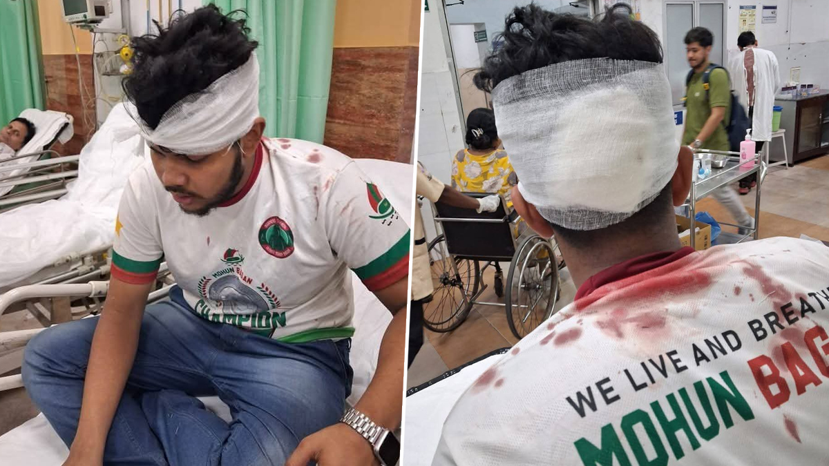 Mohun Bagan Fan Injured: মোহনবাগান ফ্যানের রক্ত ঝরল জামশেদপুরে, নিন্দা জানিয়ে পাশে দাঁড়াল ক্লাব