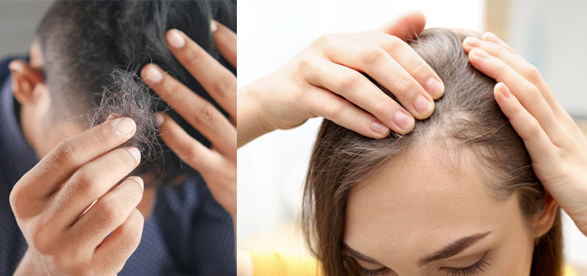 Hair fall solution: অকালে চুল পড়ে যাচ্ছে? এই পদ্ধতি মেনে চলুন। সহজেই বন্ধ হবে চুল পড়া।
