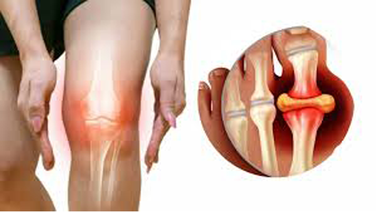 Relief from arthritis pain: মেনে চলুন এই নিয়ম।  বাতের ব্যথা যন্ত্রণা থেকে মুক্তি পাবেন