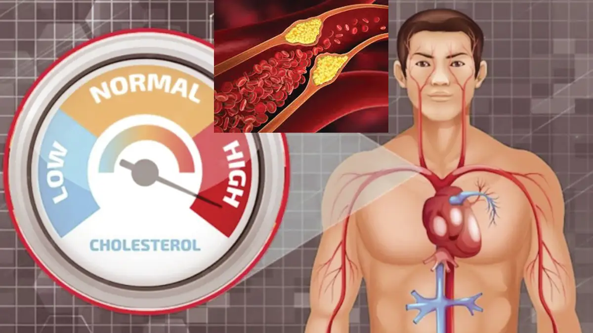 Food for control cholesterol: কোলেস্টেরল নিয়ন্ত্রন করুন। খাদ্য তালিকায় রাখুন এই খাবার গুলি