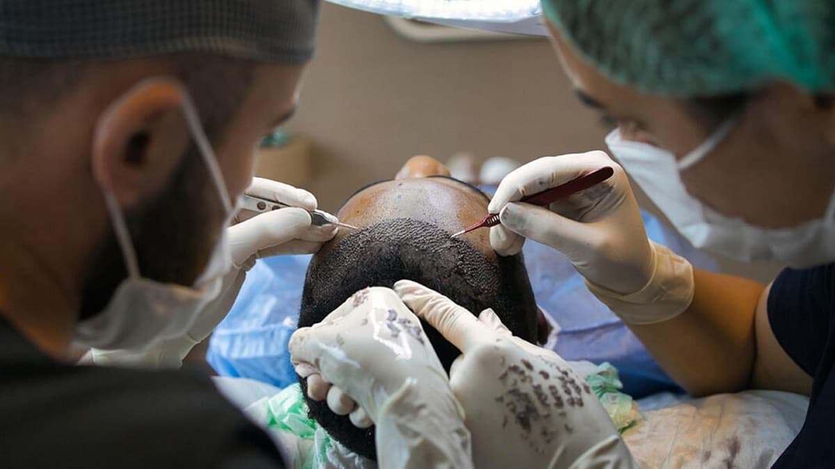 Hair Transplant Gone Wrong: সাবধান! সৌন্দর্য বাড়াতে যাবেন না যেন, হেয়ার ট্রান্সপ্লান্টে এই ব্যক্তির শরীরে বাসা বাঁধল মাংস-খেকো ব্যাকটেরিয়া