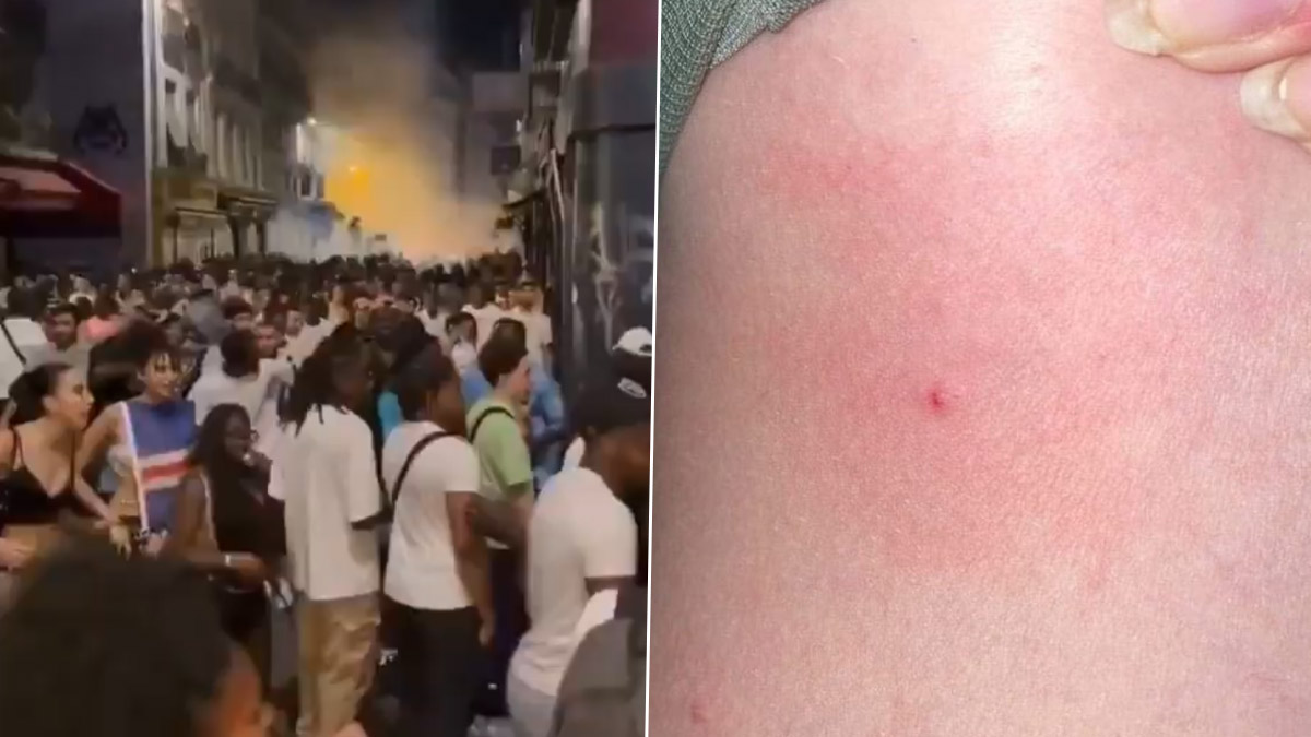 Syringe Attack in France: প্যারিস মিউজিক ফেস্টিভ্যালে চাঞ্চল্যকর কাণ্ড, দর্শকদের সিরিঞ্জ ফুটিয়ে হামলা, আহত প্রায় ১৫০
