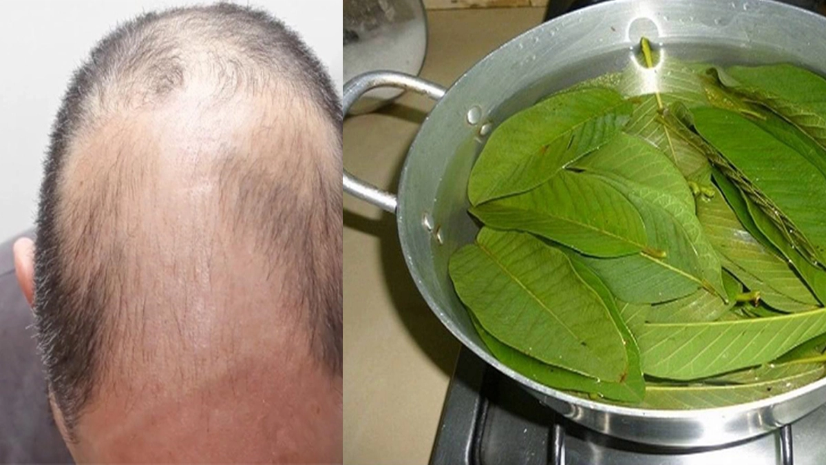 Guava leaves in hair care: টাকে গজাবে চুল। পেয়ারা পাতাতেই কামাল