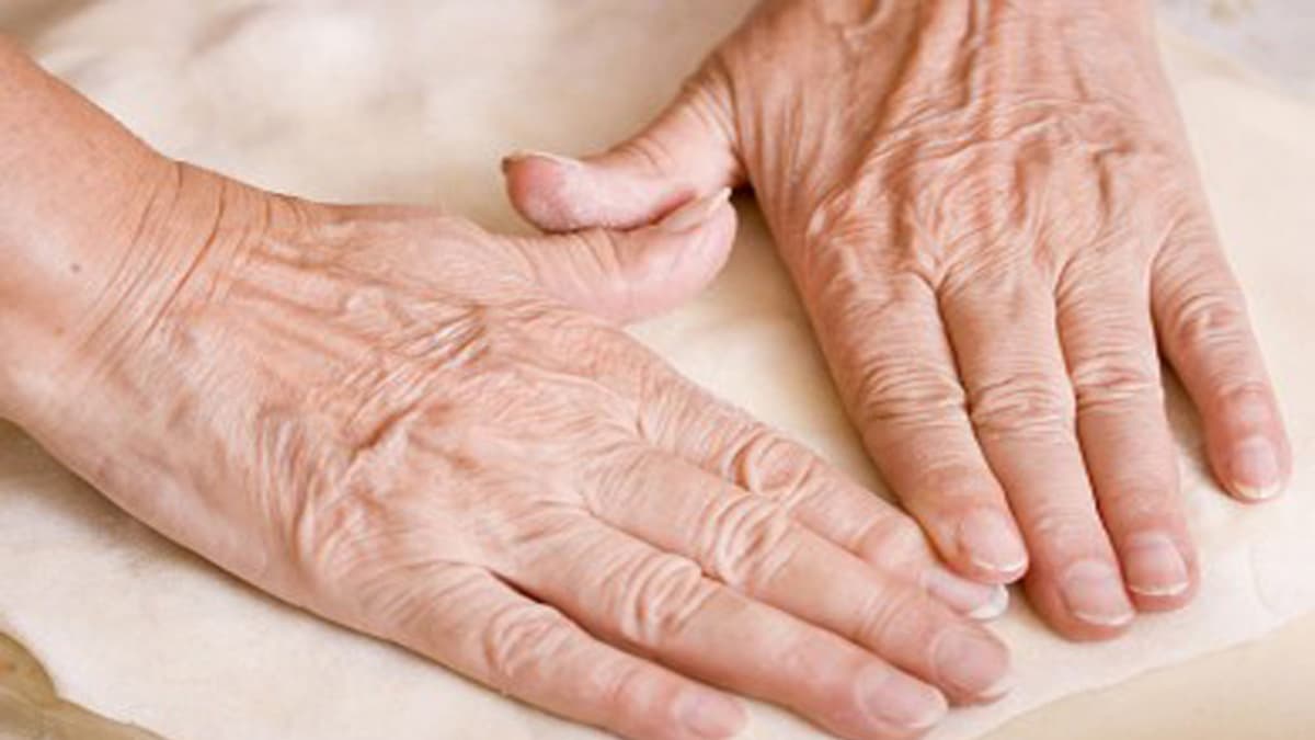 Get rid from hand skin ageing: হাতের ত্বক বুড়িয়ে যাচ্ছে? মেনে চলুন এই নিয়মগুলি। হাতের ত্বক হবে টানটান