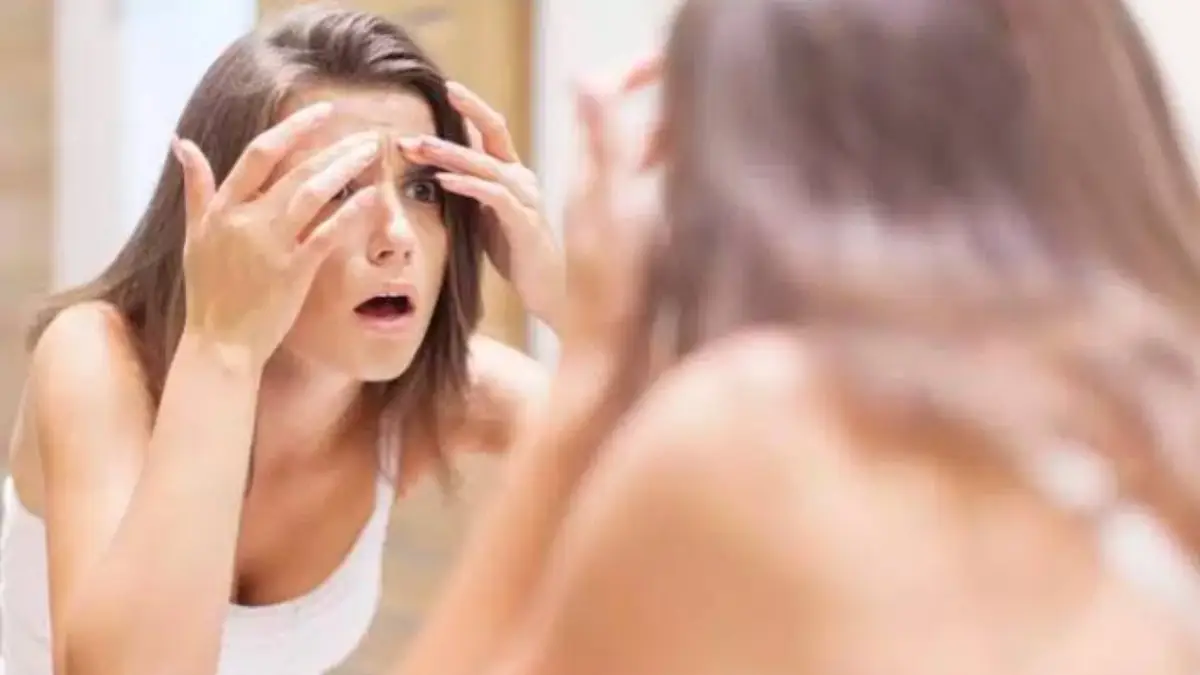 Oily Skin in Monsoon: বর্ষায় ত্বক তেলতেলে হয়ে যাচ্ছে? মেনে চলুন এই ঘরোয়া পদ্ধতি