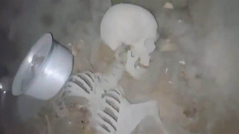 Human Skeleton Inside House: বাড়ির ভিতরেই কয়েক বছর ধরে পড়ে মানুষের কঙ্কাল, খুঁজে পেতেই হাঁড়হিম দশা স্থানীয়দের, দেখুন ভয়াবহ ভিডিয়ো