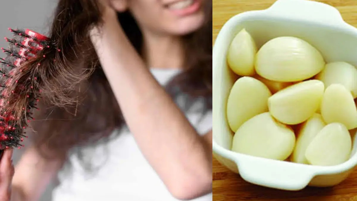 Stop Hair Fall Naturally with Garlic: চুল পড়ে যাচ্ছে? দুশ্চিন্তায় রয়েছেন? রসুনেই হবে চুল পড়া বন্ধ।  জেনে নিন কিভাবে ব্যবহার করবেন
