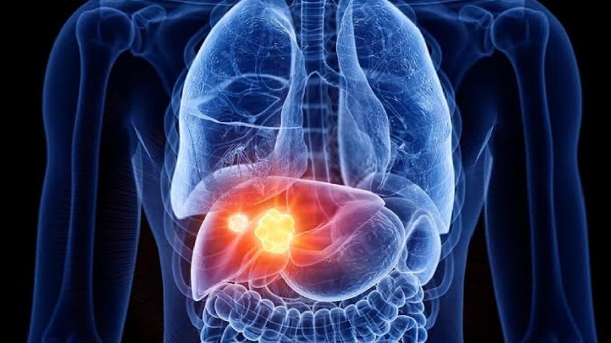 Liver-Protecting Foods :  লিভারের রোগ কাছে  ঘেষবে না। নিয়মিত খান এই খাবারগুলি
