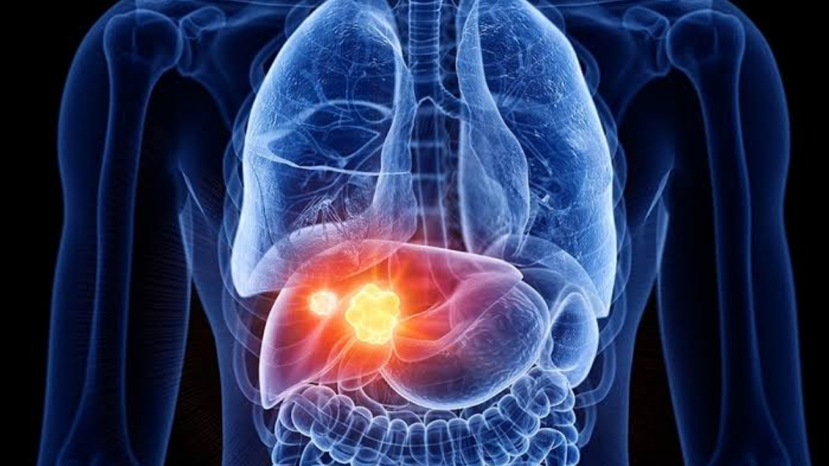 Liver-Protecting Foods :  লিভারের রোগ কাছে  ঘেষবে না। নিয়মিত খান এই খাবারগুলি