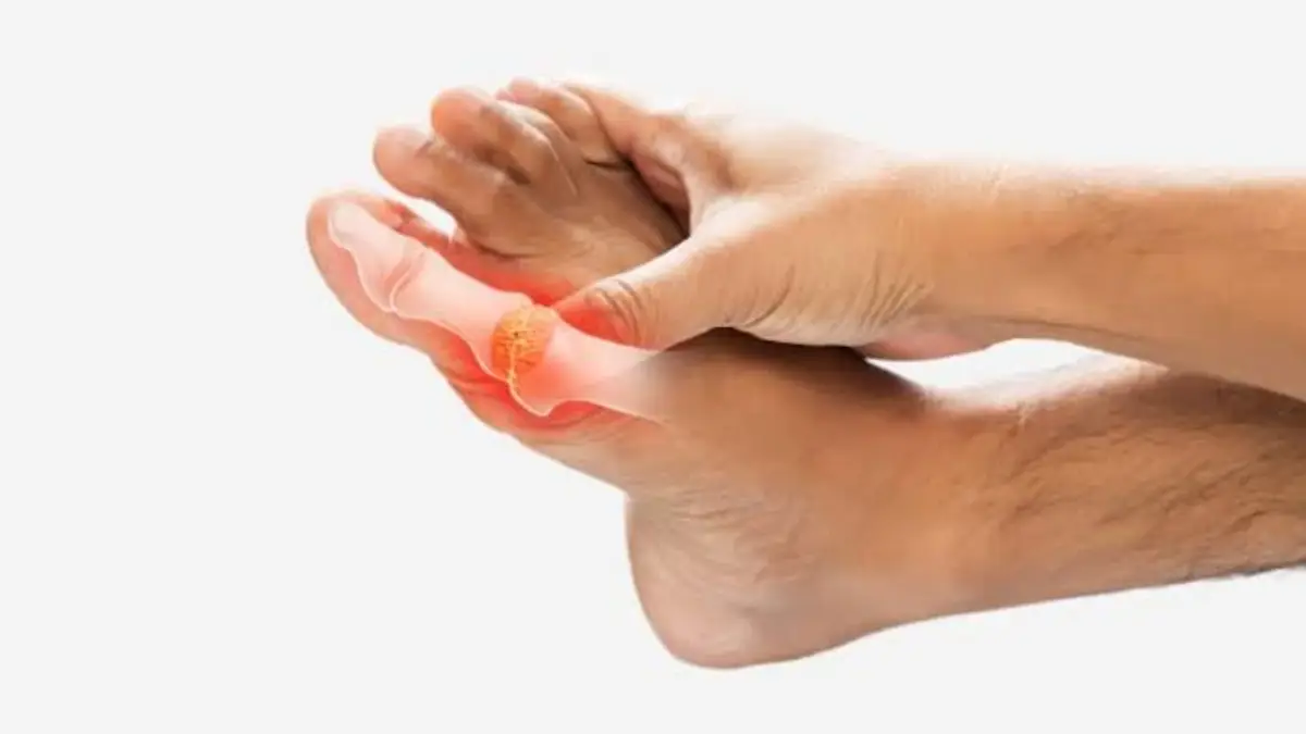 Foods to Control Uric Acid: ইউরিক অ্যাসিড নিয়ে চিন্তিত? আর চিন্তা করবেন না। নিচের খাদ্য তালিকা মেনে চলুন। সুস্থ থাকবেন