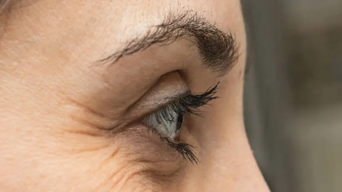 Home Remedies to Remove Wrinkles Around the Eyes: চোখের চারপাশে রিঙ্কেল?  রইল কিছু ঘরোয়া রেমিডিস। হাতেনাতে ফল পাবেন