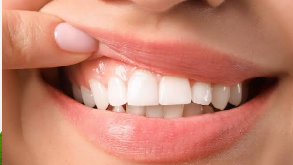 Homemade Toothpaste for Healthy Teeth:  বাজার চলতি মাজন নয়, ঘরোয়া এই উপকরণে দাঁত মাজুন – মিলবে মজবুত দাঁত ও মুক্তি দুর্গন্ধ থেকে