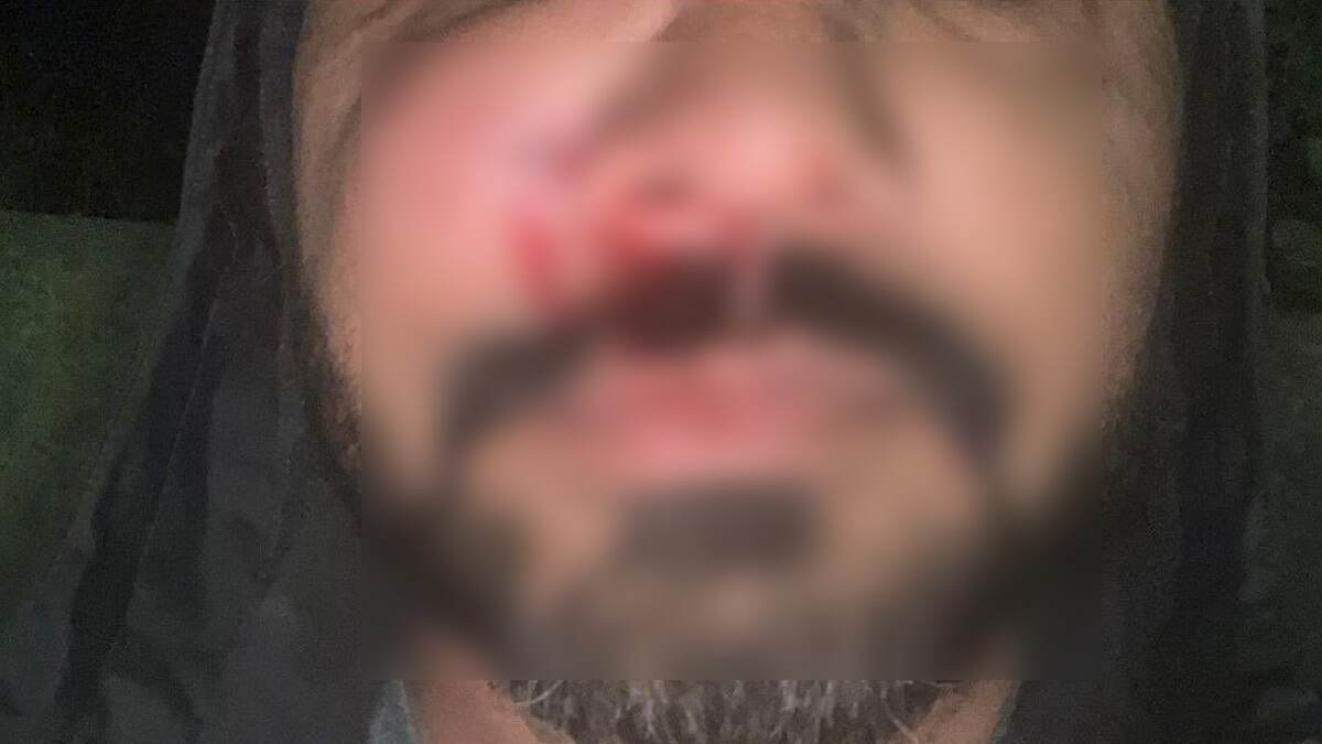 Racist Attack: অস্ট্রেলিয়ার পর আয়ারল্যান্ড, ভারতীয় বংশোদ্ভুদকে রাস্তায় ফেলে পেটানো হল ডাবলিনে, ইউরোপের ভয়াবহ ছবি