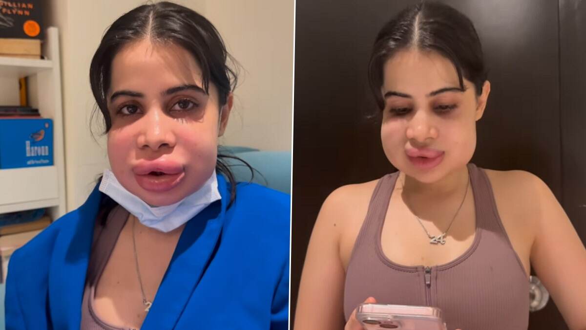 Uorfi Javed Video: গ্ল্যামারের ভয় নেই, নিজের ফুলে যাওয়া চেহারা নিয়েই ভিডিয়ো পোস্ট করলেন 'সেক্সি' ঊরফি, দেখুন