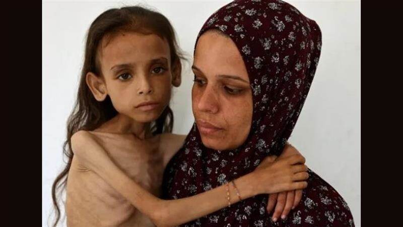 Israel-Gaza War: গাজ়ায় ভয়াবহ ছবি, না খেয়ে 'রিকেটে' পরিণত হচ্ছে শিশুরা, ইচ্ছে করেই ভুল খবর দিচ্ছে মাস্কের সংস্থা?