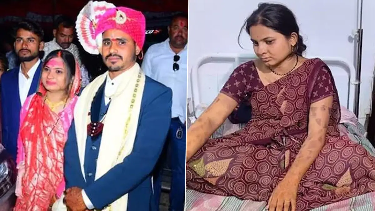 Madhya Pradesh Shocker: পণের দাবিতে ফের অত্যাচারের ঘটনা, স্ত্রীর মুখে গরম ছুরি ঢুকিয়ে দিল স্বামী
