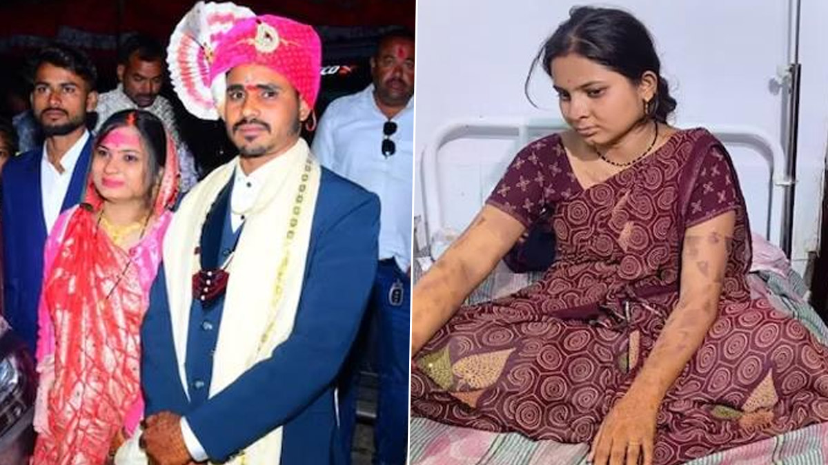 Madhya Pradesh Shocker: পণের দাবিতে ফের অত্যাচারের ঘটনা, স্ত্রীর মুখে গরম ছুরি ঢুকিয়ে দিল স্বামী