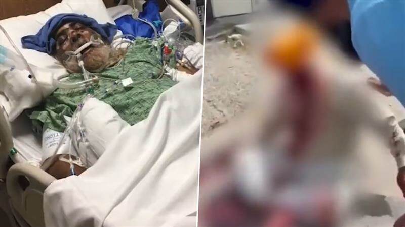 Old Man Beaten In US: পশ্চিমী দেশে বাড়ছে ভারতীয়দের উপর মারধর, আমেরিকায় বৃদ্ধকে মেরে হাড় ভেঙে দিল দুষ্কৃতীরা, নির্মম ভিডিয়ো