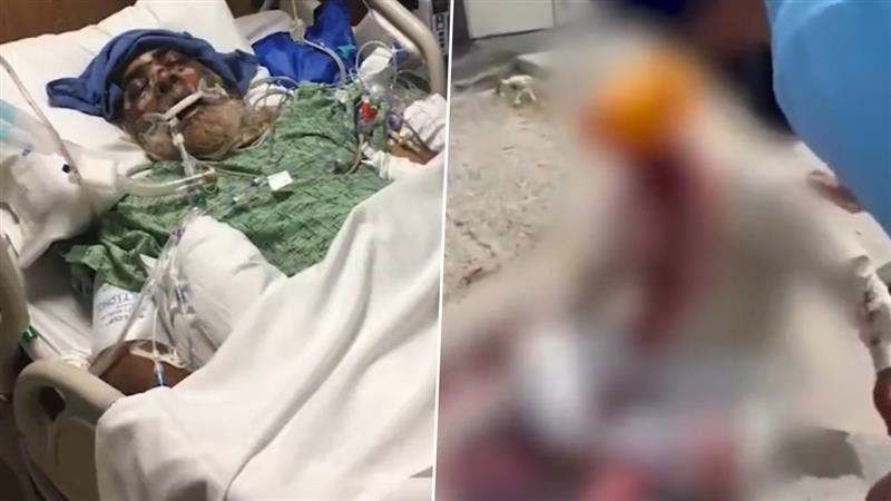 Old Man Beaten In US: পশ্চিমী দেশে বাড়ছে ভারতীয়দের উপর মারধর, আমেরিকায় বৃদ্ধকে মেরে হাড় ভেঙে দিল দুষ্কৃতীরা, নির্মম ভিডিয়ো