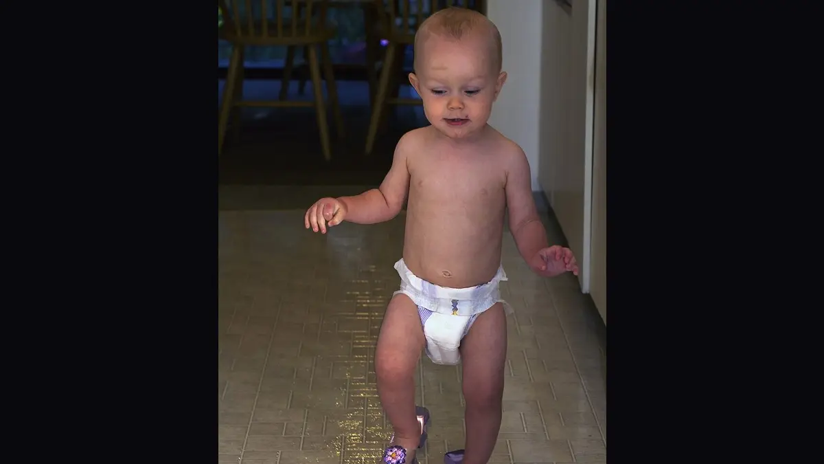 Baby Diapers: ডায়পার পরাচ্ছেন সন্তানকে, শিশুর কিডনির ক্ষতি করছেন না তো অজান্তে? ভাইরাল দাবি নিয়ে কী বলছেন চিকিৎসকরা