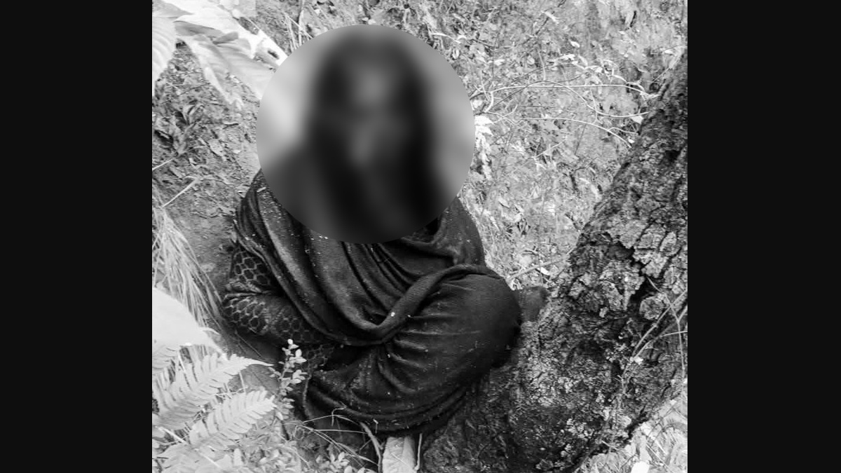 Uttarakhand Bear Attack: ভাল্লুকের হামলা, পরপর মৃত্যু, দেখুন কীভাবে মহিলার মুখ ক্ষতবিক্ষত করে দিল পাহাড়ের 'দানব'