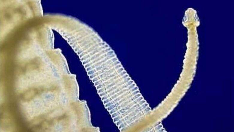 Tapeworm: মস্তিষ্কে কিলবিল করছে ৭০০ ফিতাকৃমি! আধসিদ্ধ হটপট পর্ক খেয়েই টিনিয়াসিসে আক্রান্ত চিনা ব্যক্তি Tapeworm: মস্তিষ্কে কিলবিল করছে ৭০০ ফিতাকৃমি! আধসিদ্ধ হটপট পর্ক খেয়েই টিনিয়াসিসে আক্রান্ত চিনা ব্যক্তি