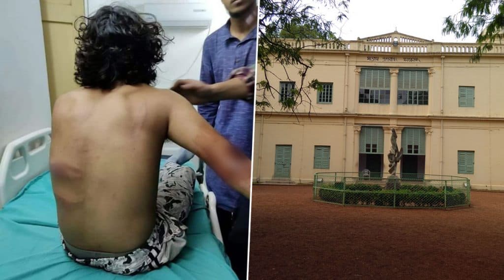 Attack On Visva Bharati Students: জেএনইউ-র ছায়া বিশ্বভারতী বিশ্ববিদ্যালয়ে, হোস্টেলের বাইরে ছাত্রদের রড-লাঠি দিয়ে মার বিজেপির Attack On Visva Bharati Students: জেএনইউ-র ছায়া বিশ্বভারতী বিশ্ববিদ্যালয়ে, হোস্টেলের বাইরে ছাত্রদের রড-লাঠি দিয়ে মার বিজেপির