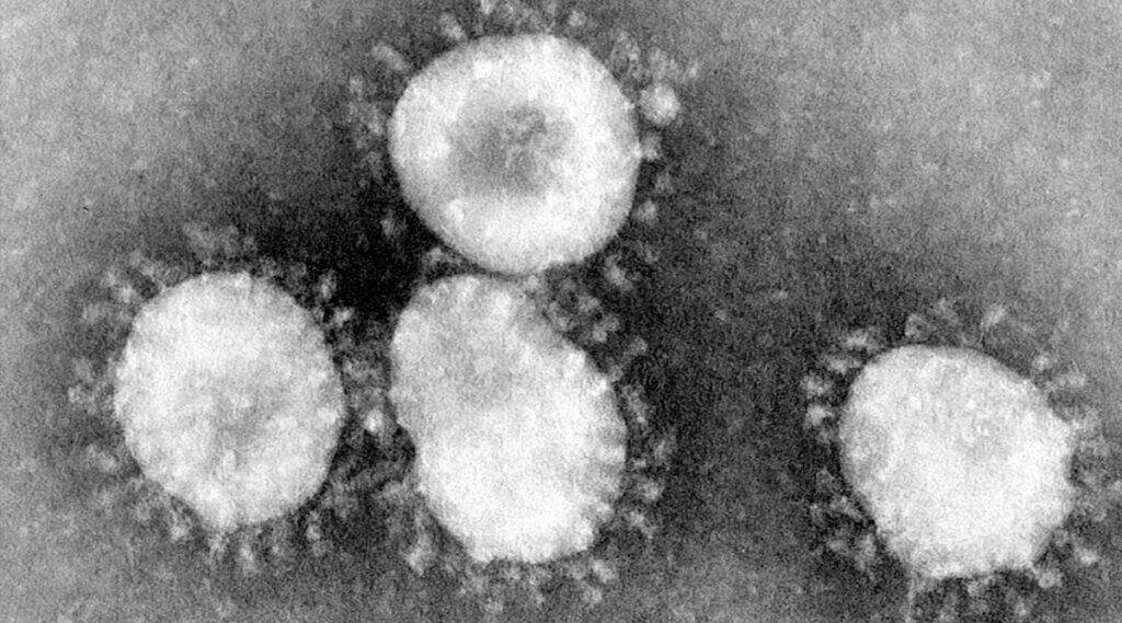 Coronavirus: কলকাতায় মিলছে না করোনা ভাইরাস মোকাবিলার চিকিৎসা পরিকাঠামো! কপালে ভাঁজ চওড়া হচ্ছে চিকিৎসকদের Coronavirus: কলকাতায় মিলছে না করোনা ভাইরাস মোকাবিলার চিকিৎসা পরিকাঠামো! কপালে ভাঁজ চওড়া হচ্ছে চিকিৎসকদের