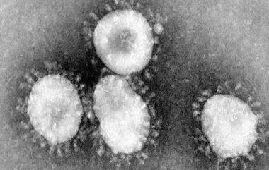 Coronavirus: কলকাতায় মিলছে না করোনা ভাইরাস মোকাবিলার চিকিৎসা পরিকাঠামো! কপালে ভাঁজ চওড়া হচ্ছে চিকিৎসকদের