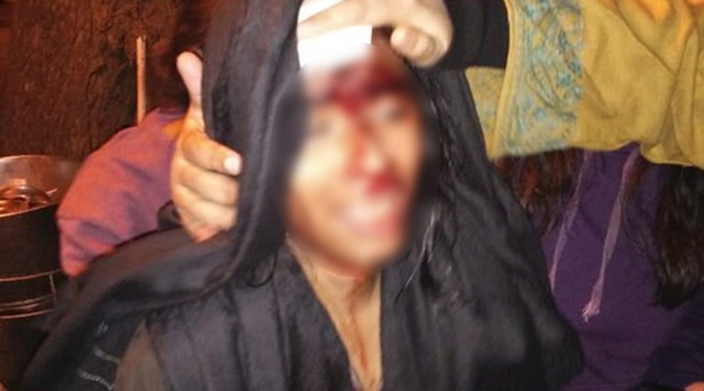 Violence In JNU: JNU ক্যাম্পাসে হামলা 'ABVP'-র , মাথা ফাটল ছাত্র সংসদের সভাপতি ঐশী ঘোষের