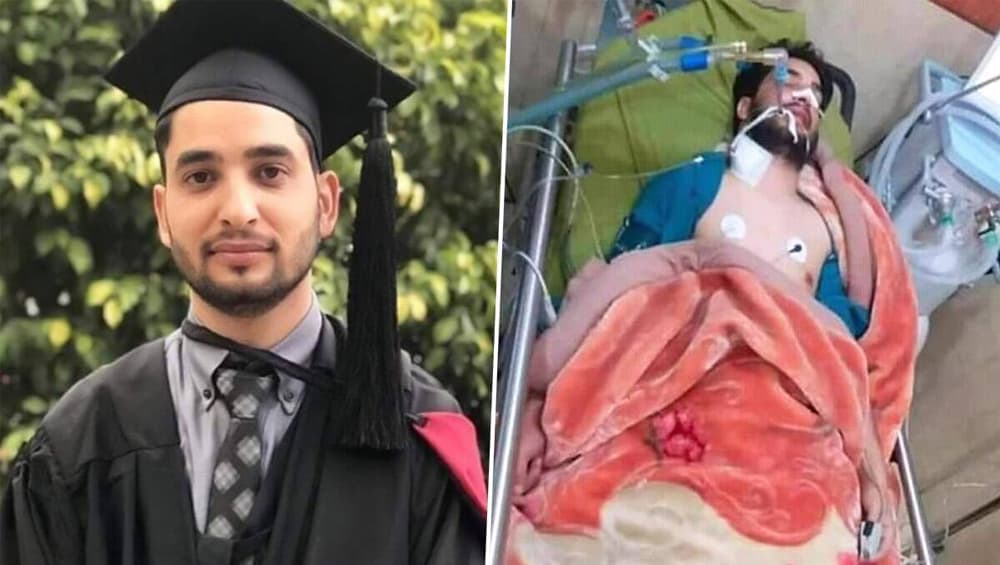 Pakistan 'Hero' Doctor Usama Riaz Died After Fight Against COVID-19: করোনাভাইরাস রুখতে সামনে থেকে লড়ছিলেন, প্রয়াত পাকিস্তানের তরুণ চিকিৎসক উসামা রিয়াজ Pakistan 'Hero' Doctor Usama Riaz Died After Fight Against COVID-19: করোনাভাইরাস রুখতে সামনে থেকে লড়ছিলেন, প্রয়াত পাকিস্তানের তরুণ চিকিৎসক উসামা রিয়াজ