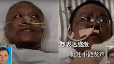 Wuhan Doctors: করোনা থাবা থেকে বেঁচে ফিরলেও ধীরে ধীরে কালো হয়ে যাচ্ছেন চিনের ২ চিকিৎসক