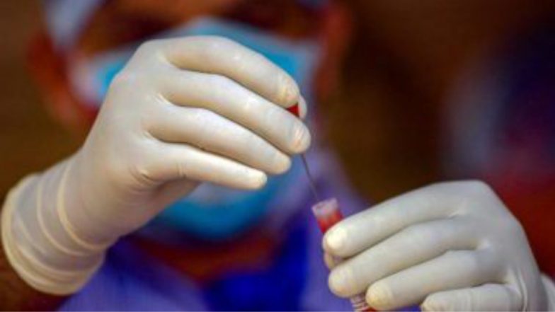 COVID-19 Vaccine Latest News Update: রাশিয়ার করোনা ভ্যাকসিনের তৃতীয় পর্যায়ের পরীক্ষামূলক প্রয়োগ এবার ভারতে, এখানেই তৈরি হবে স্পুটনিক ভি
