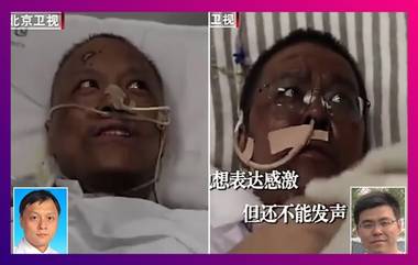 Wuhan Doctors Skin Turned Dark|COVID-19: করোনা চিকিৎসার মাঝে দুই চিকিৎসকের গায়ের চামড়া হয়ে যায় কালো