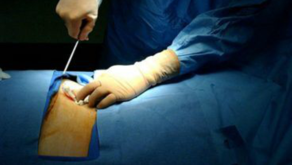 India's First-Ever Intestine Transplant: ছেলেকে বাঁচাতে ২০০ সেন্টিমিটার অন্ত্র দান বাবার, ভারতে এই প্রথম  করোনা আক্রান্তের অঙ্গ প্রতিস্থাপন
