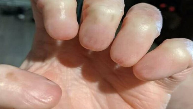 Viral: হাতের আঙুলে নেই নখ, ভাইরাল ছবি দেখে অবাক নেটিজেনরা