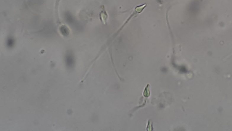 Sperm Counts  Decline: ভারতে কমছে পুরুষদের 'স্পার্ম কাউন্ট', বাড়ছে ক্যানসারের প্রবণতা