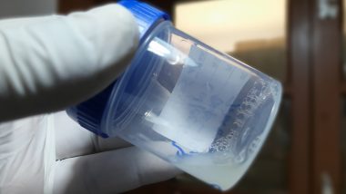 Court Orders Sperm Donor To Stop Donating: বিশ্বজুড়ে তাঁর শুক্রাণুতে জন্ম নিয়েছে প্রায় ৬০০ শিশু, এবার তাঁকেই শুক্রাণুদানে নিষেধাজ্ঞা আদালতের