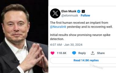 Elon Musk on Neuralink: মানুষের মস্তিষ্কে চিপ বসিয়েছে ইলন মাস্কের কোম্পানি, এই চিপ বদলে দিতে পারে মানুষের জীবন