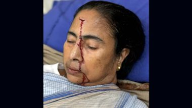 Mamata Banerjee Injured: চোট পেলেন মুখ্যমন্ত্রী  মমতা বন্দ্যোপাধ্যায়, কপাল ফেটে রক্ত, ভর্তি হাসপাতালে