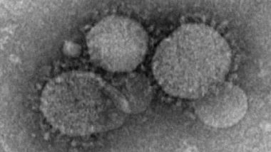 MERS Coronavirus: সৌদি আরবে ছড়াচ্ছে মার্স করোনা ভাইরাস! আক্রান্ত ৪, উদ্বেগ প্রকাশ বিশ্ব স্বাস্থ্য সংস্থার