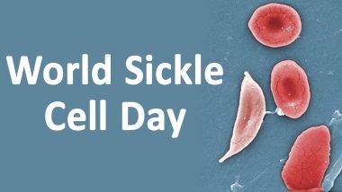 World Sickle Cell Day 2024: মারাত্মক রক্ত সংক্রান্ত রোগের নাম সিকেল সেল রোগ, জেনে নিন সিকেল সেল রোগ সম্বন্ধে বিস্তারিত...